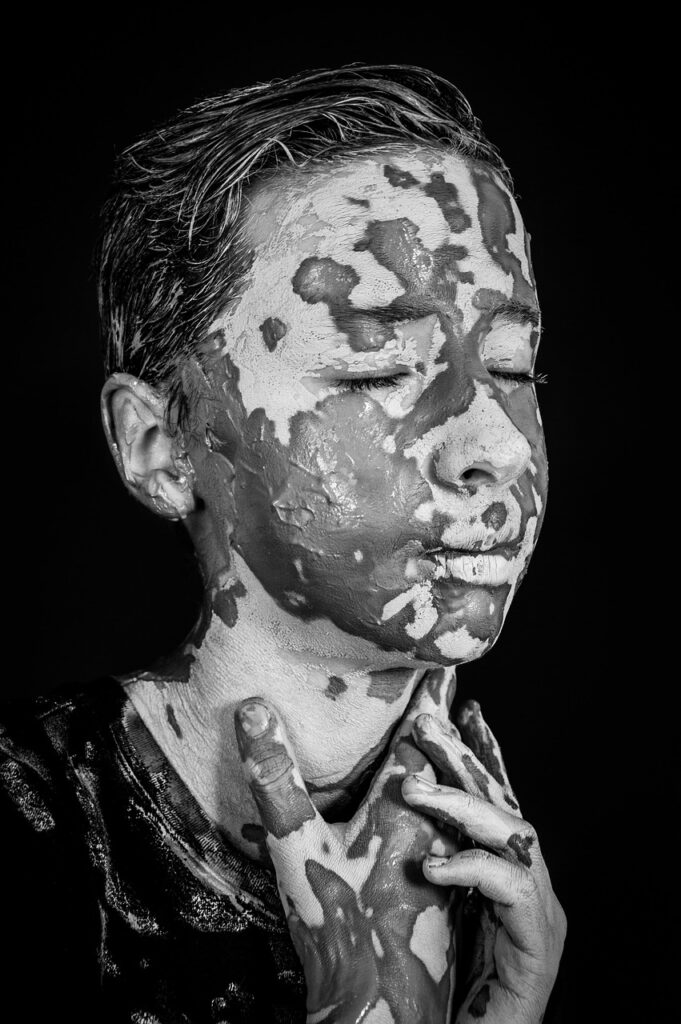 背中のニキビによる色素沈着を男性が治す方法は？