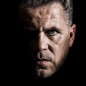 男性の顔のニキビ跡を効果的に治す方法は？