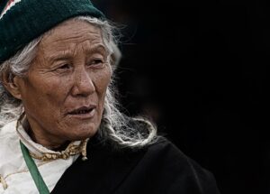 ニキビの場所によって異なる意味とは？